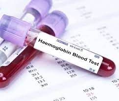 Lucknow News | CSIR IITR develops rapid haemoglobin testing kit; fast and affordable test at ₹10
