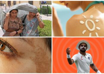 What nobody tells you about surviving summers: Skin & Haircare edition 