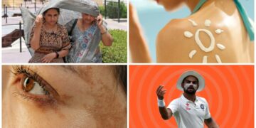 What nobody tells you about surviving summers: Skin & Haircare edition 